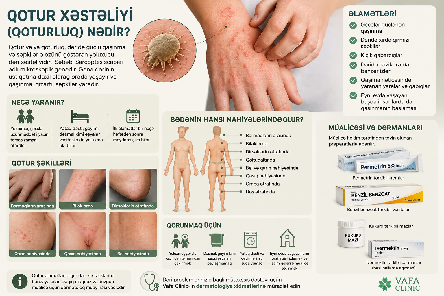 qotur xesteliyi nedir