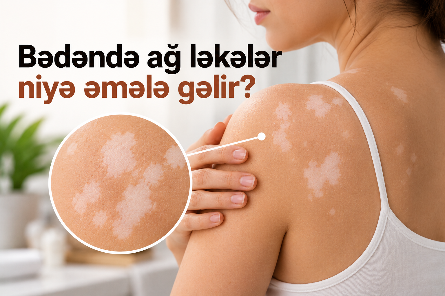 Bədəndə ağ ləkələr niyə əmələ gəlir?