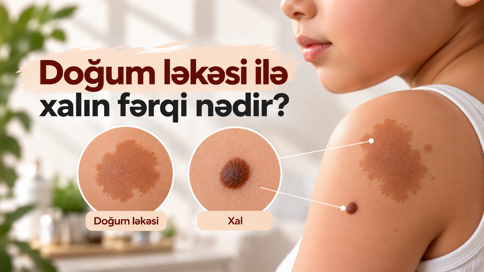 Doğum ləkəsi ilə xalın fərqi