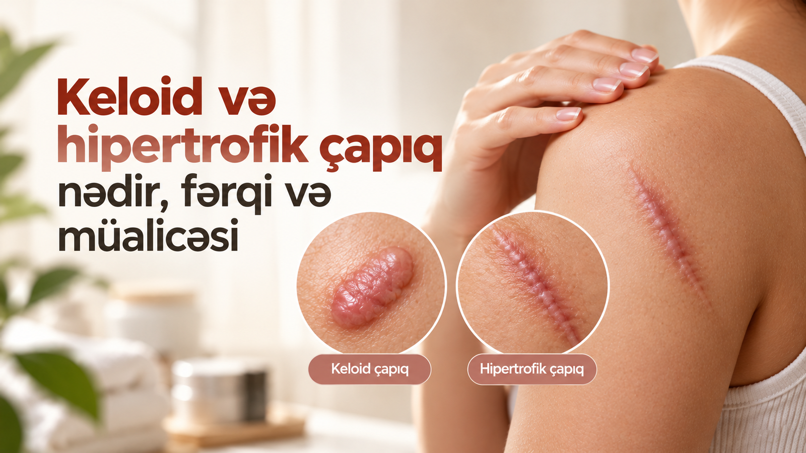 Keloid və hipertrofik çapıq nədir, fərqi və müalicəsi
