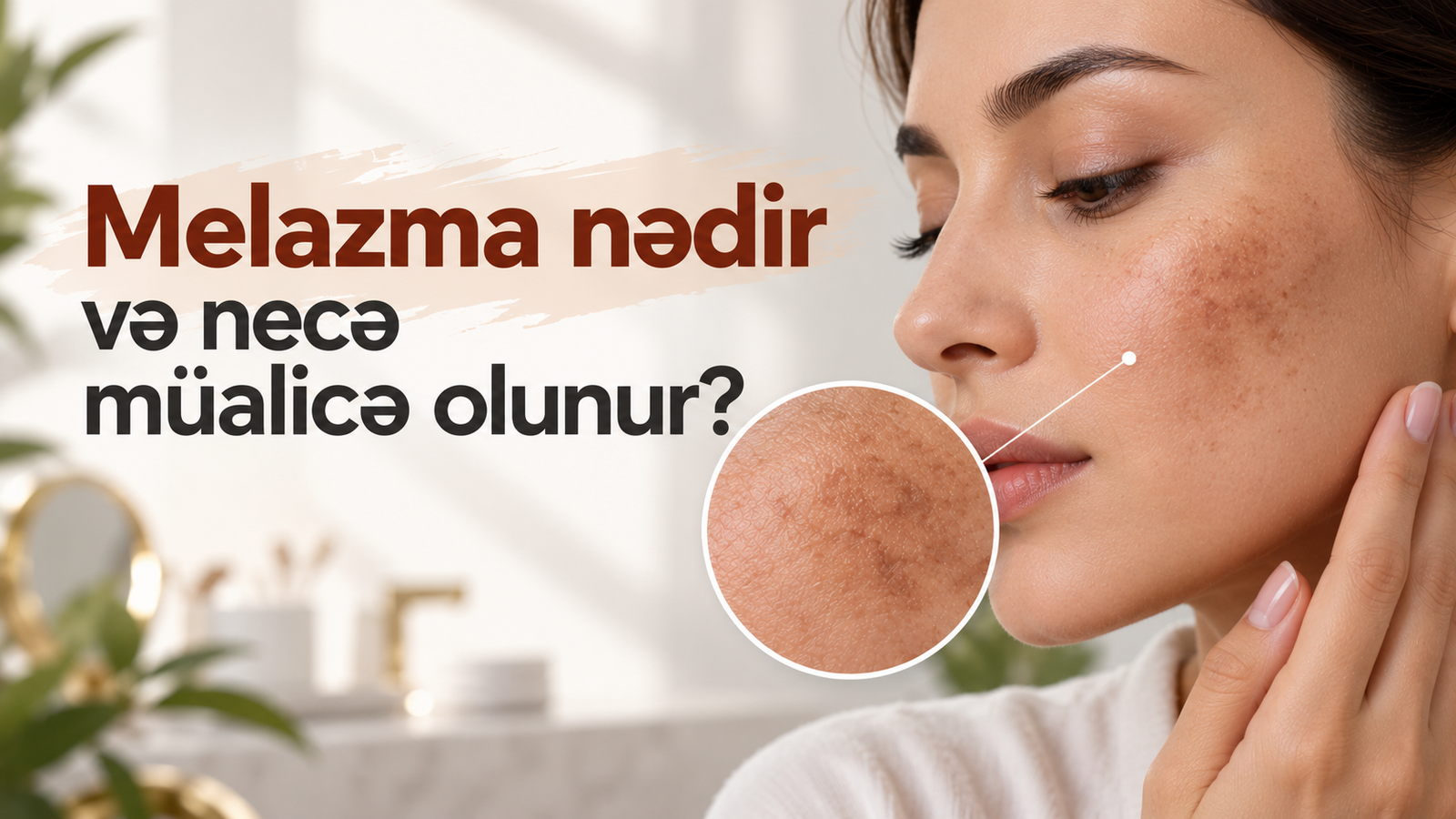 Melazma nədir və necə müalicə olunur