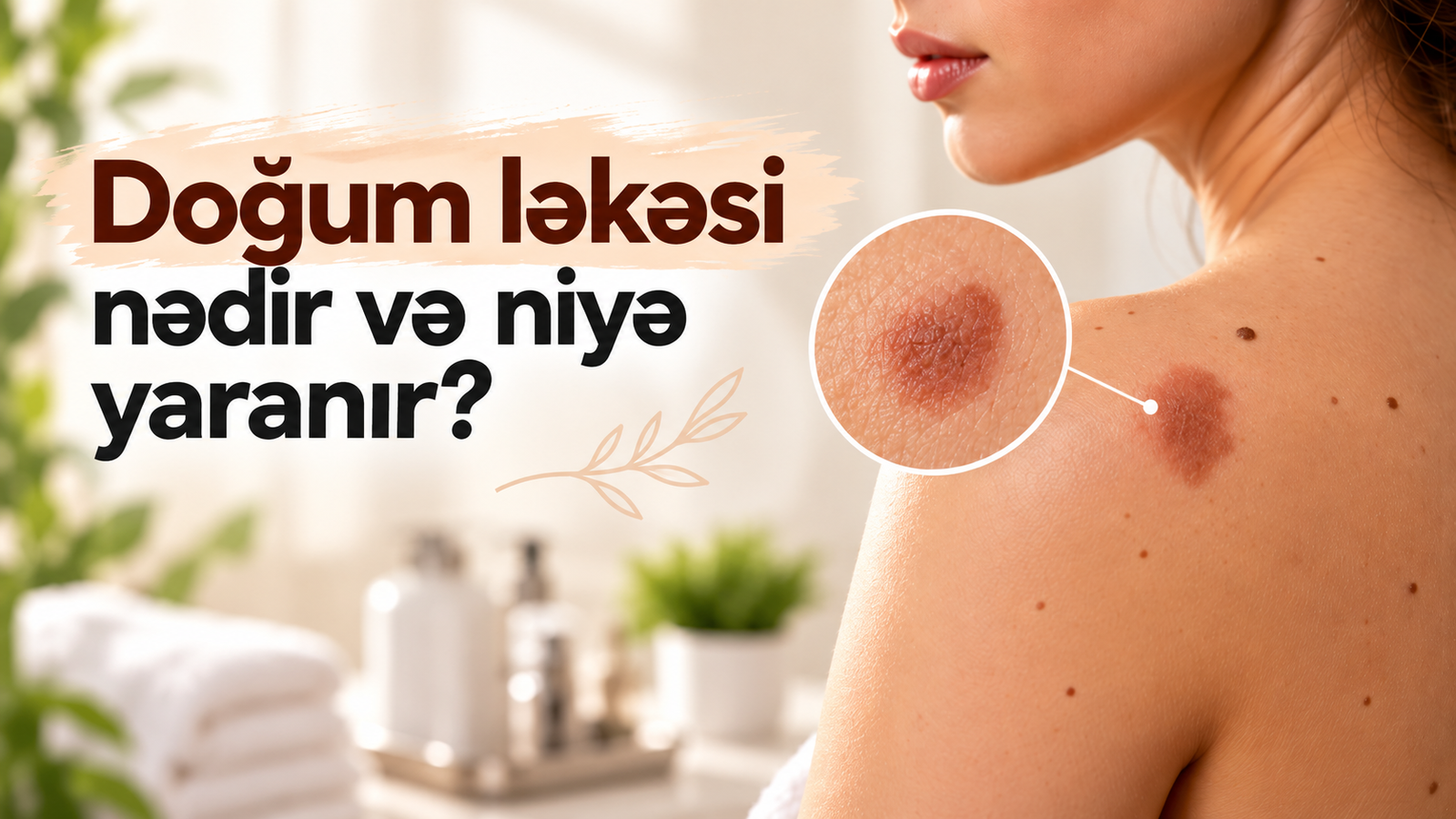 Doğum ləkəsi nədir və niyə yaranır