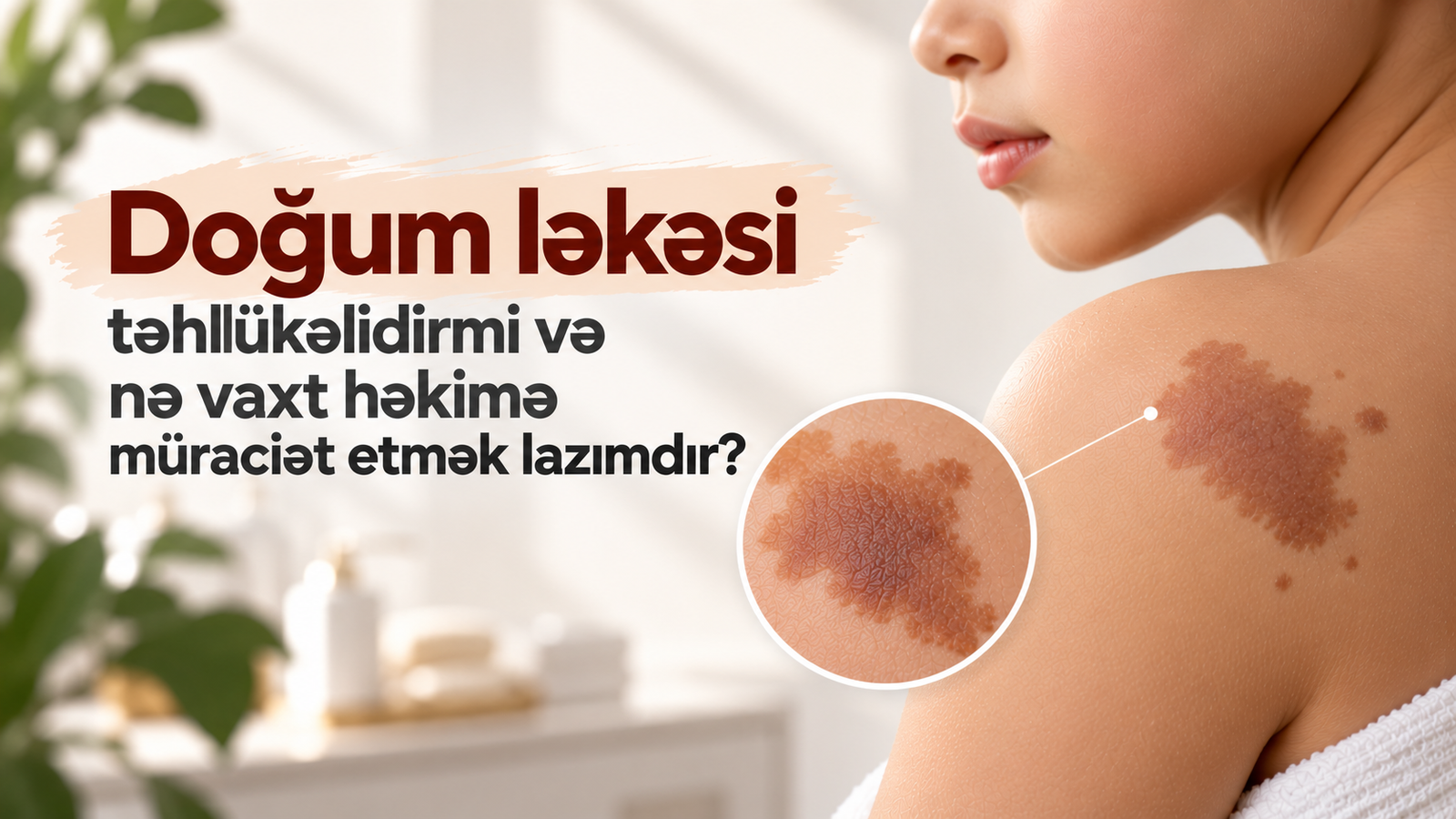 Doğum ləkəsi təhlükəlidirmi və nə vaxt həkimə müraciət etmək lazımdır